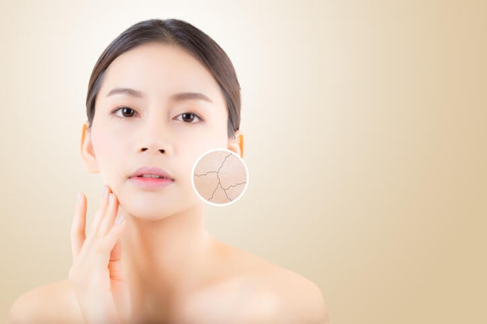 Why Is My Skin So Dry?