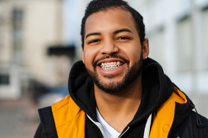 Caring for Teeth With Braces