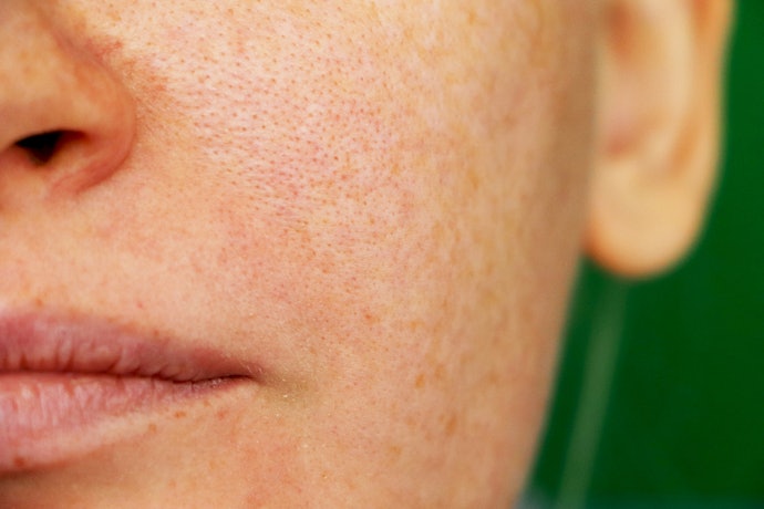 Neutralize Free Radical Damage and Calm Inflammation With Antioxidants