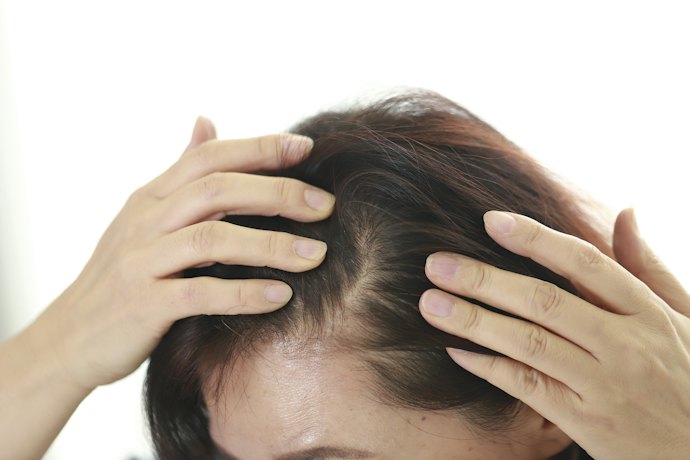 Consider Hair Regrowth Products for Thin Hair