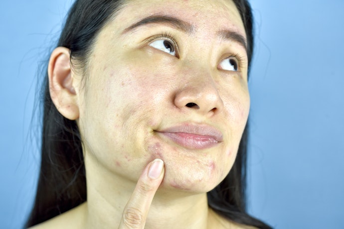 Take Note of Bacteria-Fighting Ingredients Like Zinc