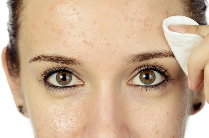 Oily Skin Needs Something Light and Hydrating Like Fluids or Gels