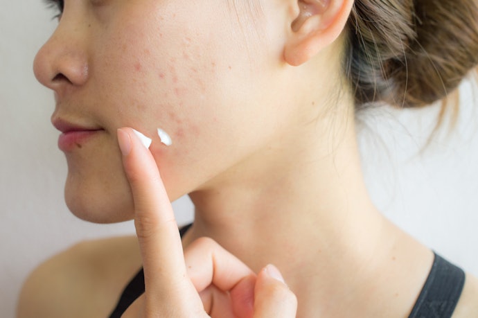 Non-Comedogenic Formulas for Oily and Acne-Prone Skin