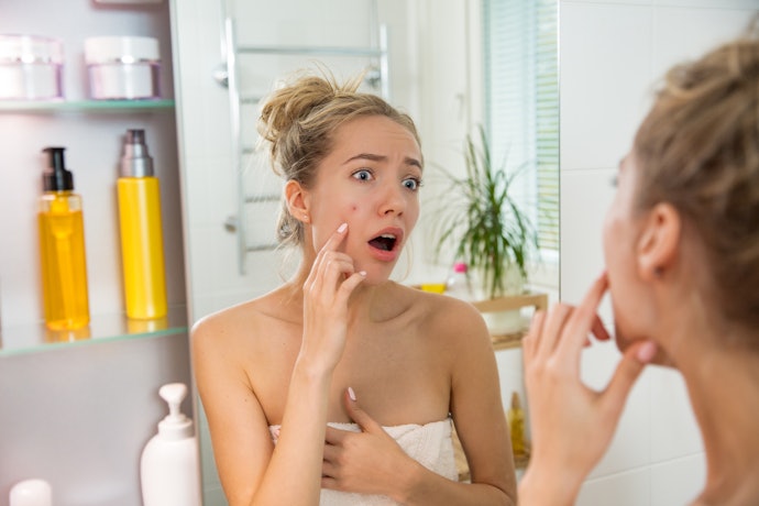 Medicated Acne Patches Target New and Inflamed Acne