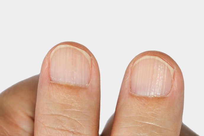 Look for Vitamin-Rich and Moisturizing Oil to Reduce Ridges and Splitting