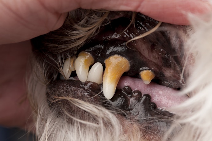 Sugars and Carbohydrates Can Cause Dental Diseases