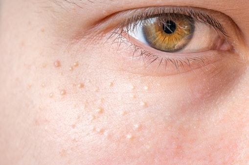A Non-Comedogenic Formula for Oily or Acne-Prone Skin