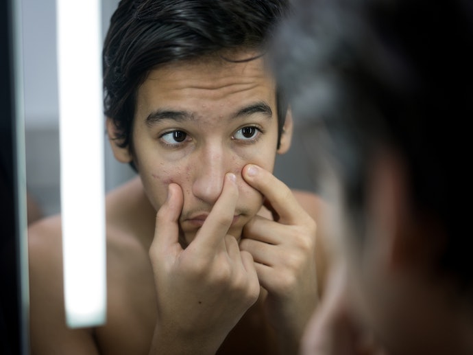 Salicylic Acid, AHAs, and Topical Retinoids are Ideal for Non-Inflammatory Acne