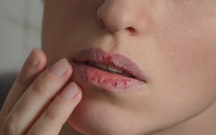 Botanical Extracts, Hyaluronic Acid, and More Soothe and Moisturize Cracked Lips