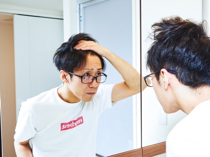 If It's Male Pattern Hair Loss, Avoid DHT
