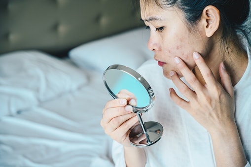 Regular Foaming Cleansers Work for Oily or Acne-Prone Skin