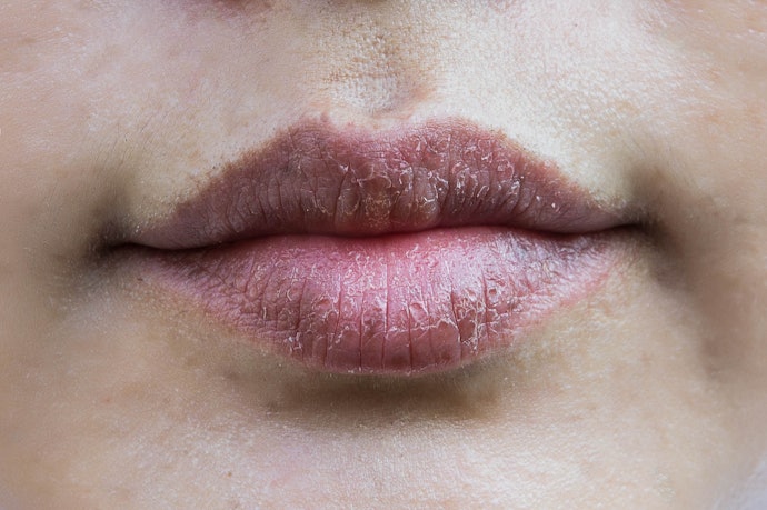 Natural Exfoliants Will Address Dead Skin Cell Build Up