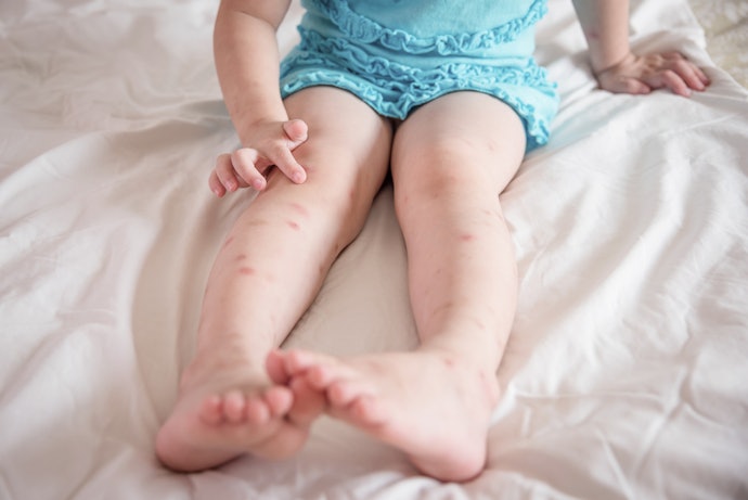 Got Allergies? Find a Hypoallergenic Protector