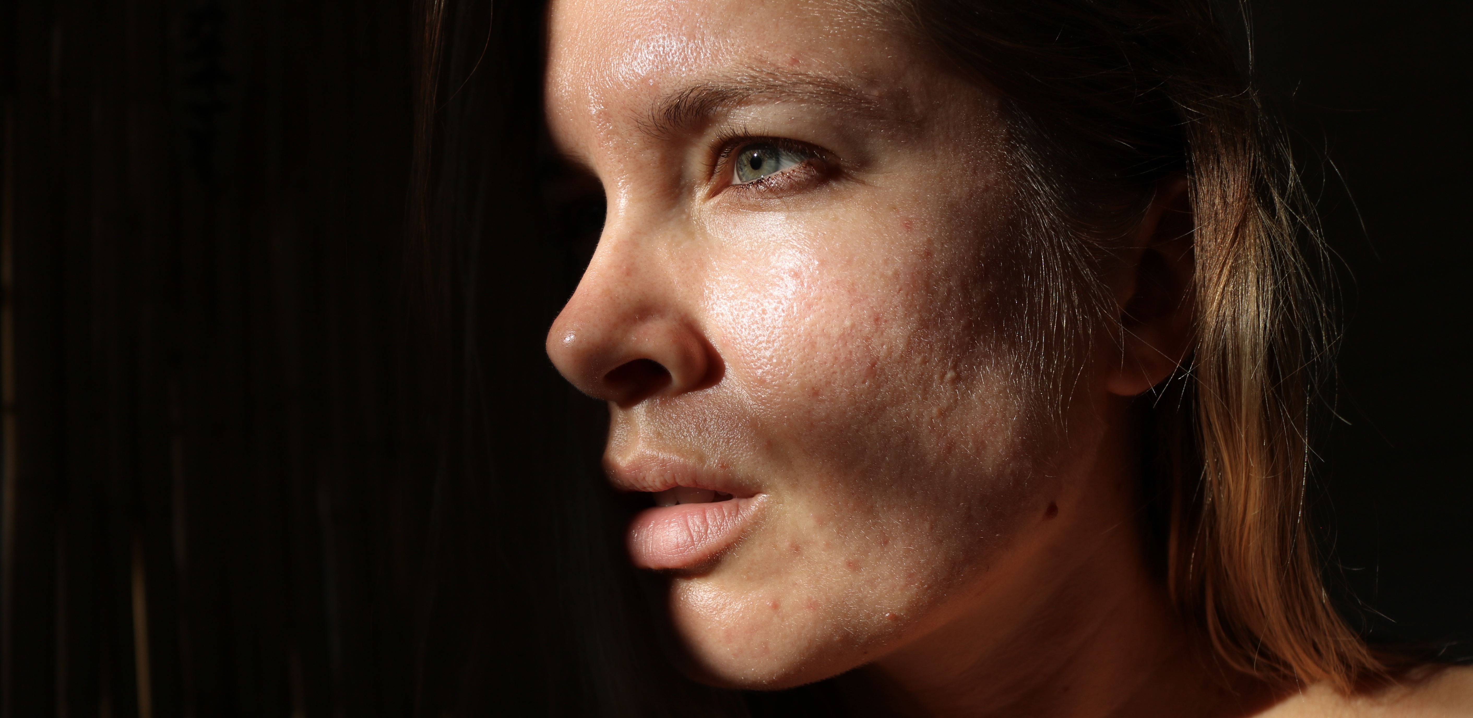 Joanna Kenny's Top 10 SPFs for Acne-Prone Skin		