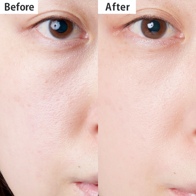 Whitening BB 3