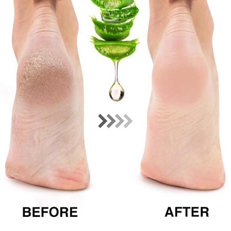 Foot Peel Exfoliating Mask 2