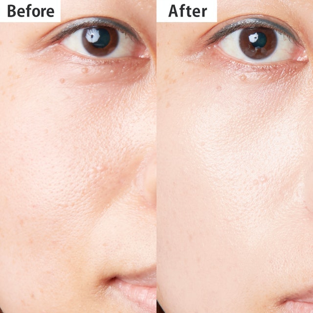 d Program Allerbarrier Essence BBN 4