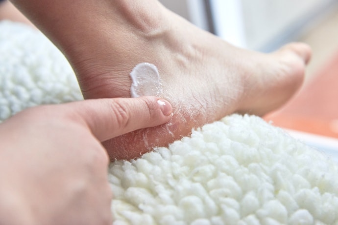 Find Moisturizers That Can Treat Your Calluses