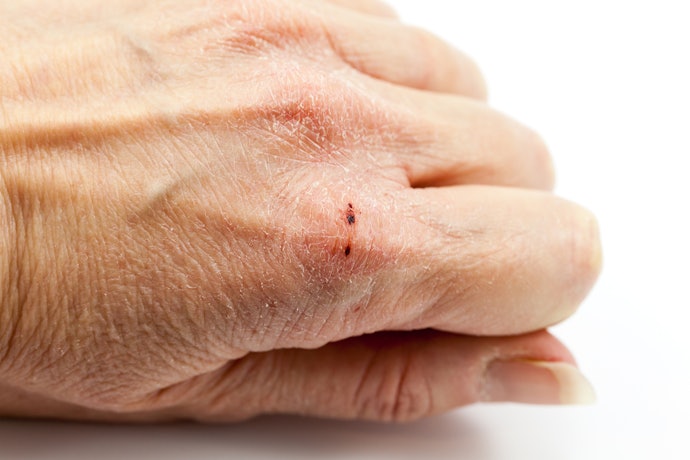 Fatty Substances Restore and Soothe Chapped Hands