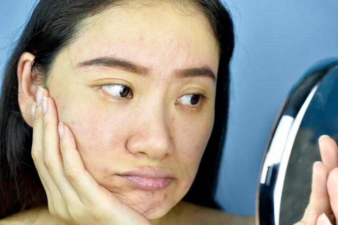 Those With Sensitive Skin Need to Read Ingredient Lists