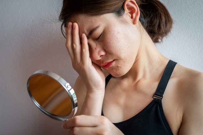 Soothing Ingredients Can Benefit Sensitive Skin