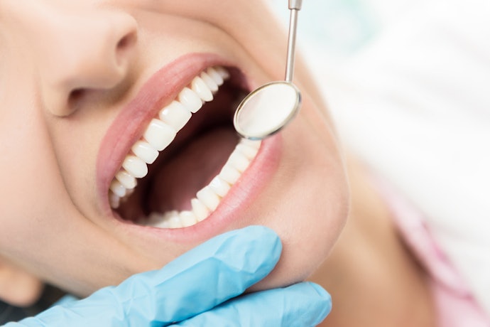 Look for Fluoride to Prevent Cavities