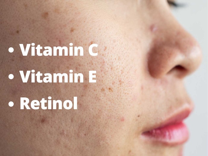 Anti-Inflammatory Ingredients Can Minimize Your Pores